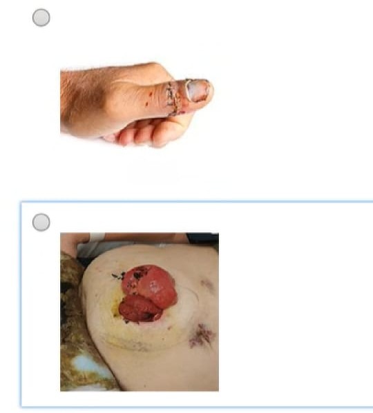 Option A